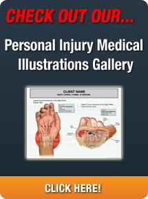 Seattle Personal Injury Attorney Illustration Gallery