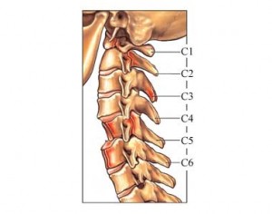 neckfracture seattle car accident law firm