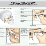 TMJ Injury Caused by Car Accident
